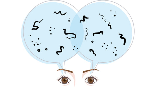 Miodesopsias ("moscas volantes")