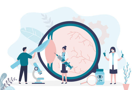 Cataratas: Un problema común pero evitable